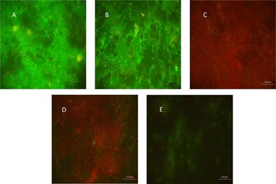 Antimicrobial effects of XF drugs against Candida albicans and its biofilms